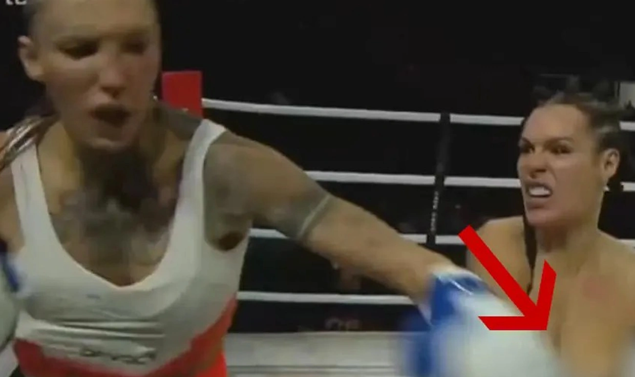Luta Inusitada Hoje No Fight Music Show: Mendigata Vence Zoo Com Seio Exposto