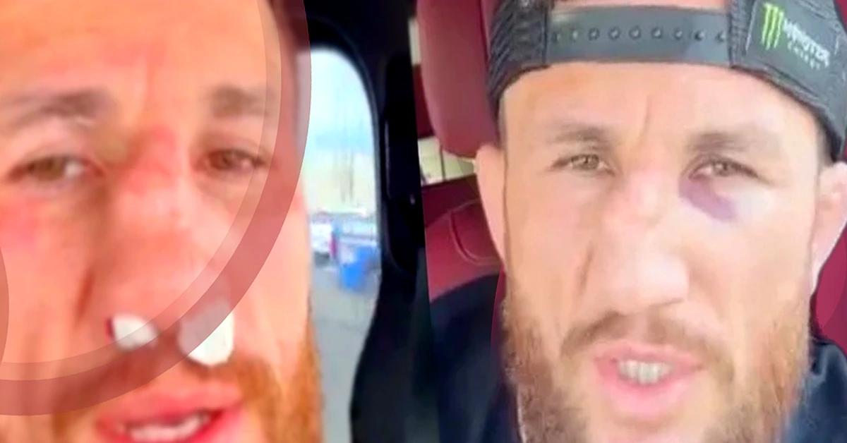 Merab Dvalishvili conquista vitória épica sobre Frankie Edgar apesar de mais um nariz quebrado